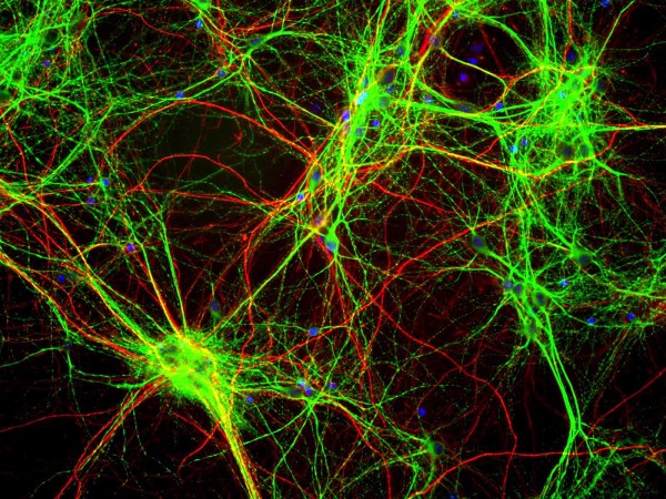 brain-cells